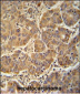 ATP5D Antibody (N-term)